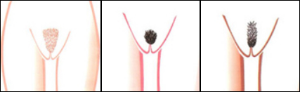 Waxing Styles Waxing Spa Liverpool